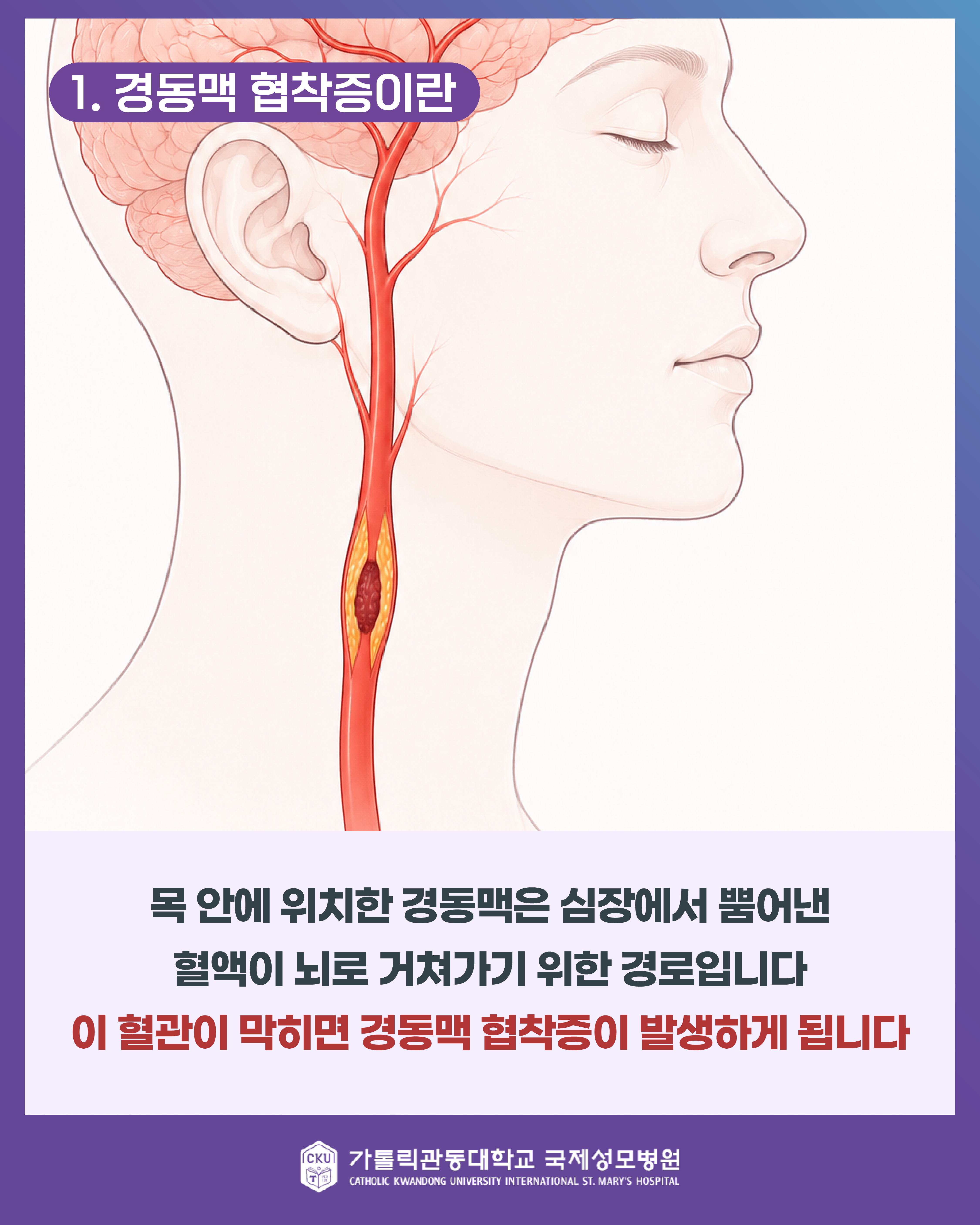 %20%20%20%20%20%20%20%20-%20%20%20%20%20%20%20%20%20v3(10801350)-02.png