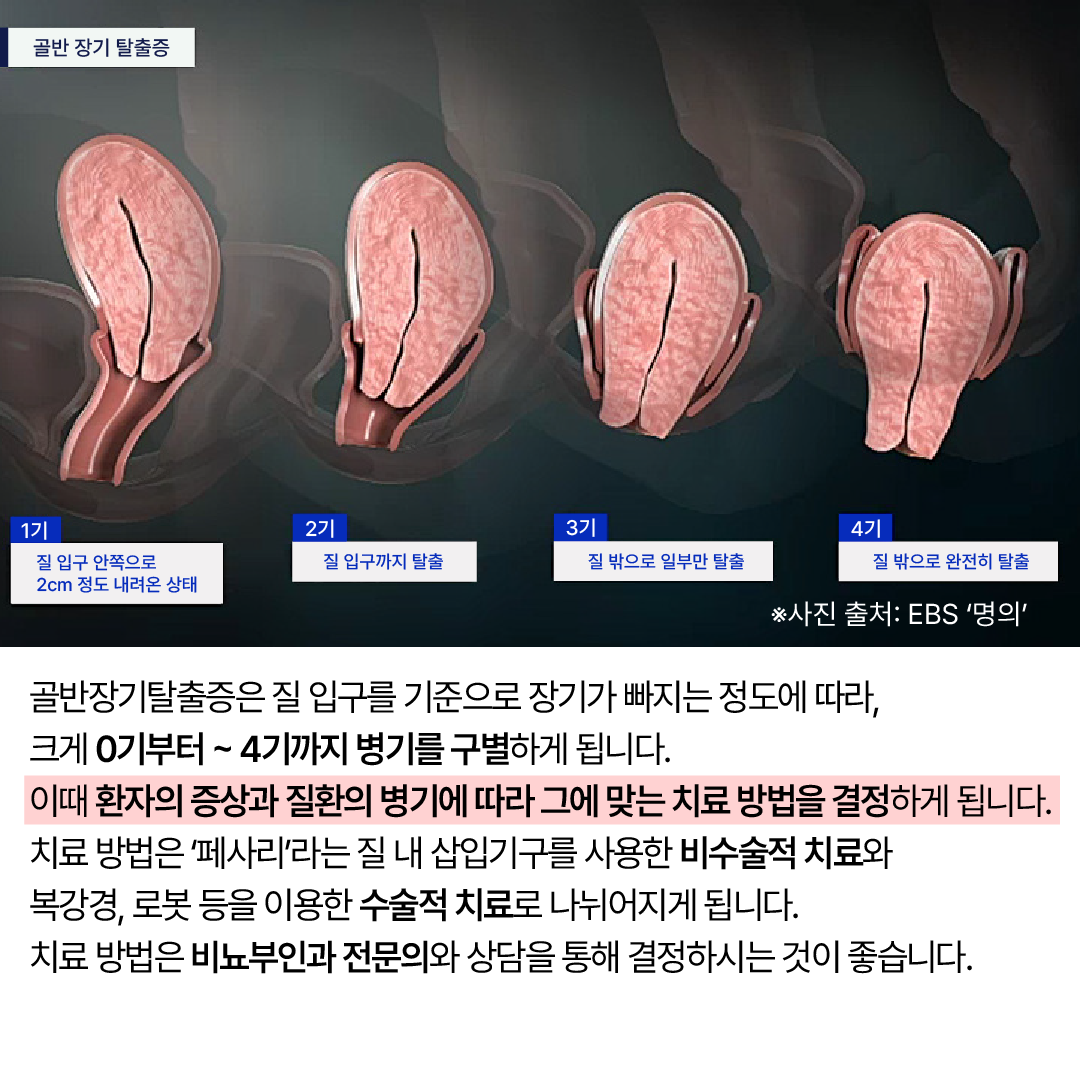 %20%20%20%20%20%20%205.png